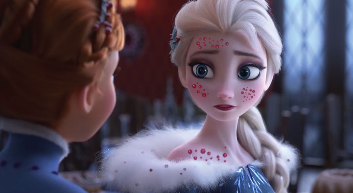 Elsa get chicken pox