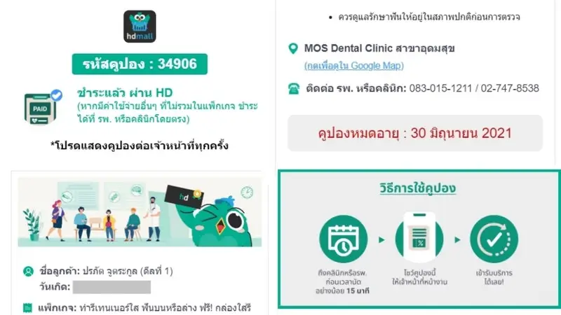 คูปองการจองทำรีเทนเนอร์ใส ที่ MOS Dental Clinic สาขาอุดมสุข