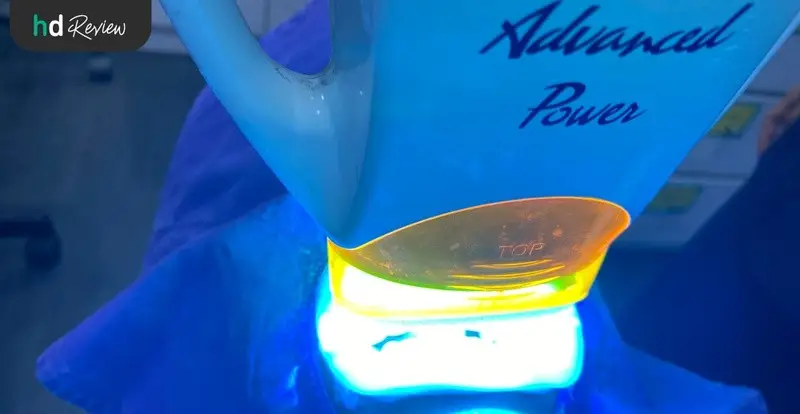 รีวิว ฟอกสีฟัน น้ำยา PolaOffice ที่ Zenitoni Dental Clinic