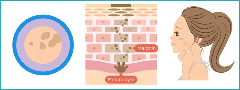 ความไวต่อแสงแดด \(Sun Sensitivity\)