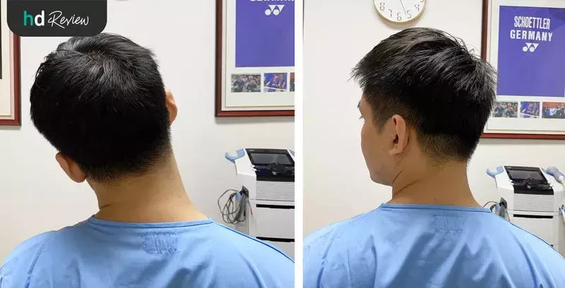 ขั้นตอนการตรวจเช็กอาการออฟฟิศซินโดรม
